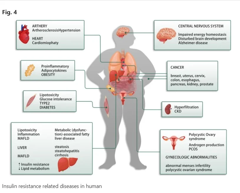 Carbs and Insulin resistance. MetaWell Nutritionist Minna Wood Bracknell Gut Health Mental Health Food and Mood