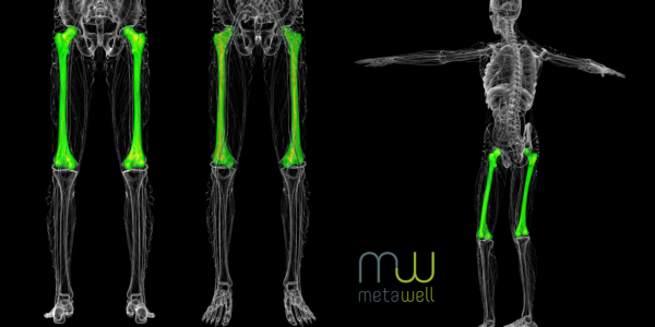 Healthy Bones = Your Longevity Insurance