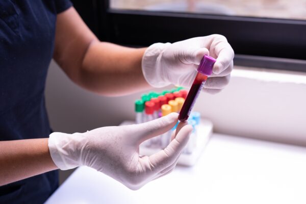 Blood tests & hot weather: What you need to know